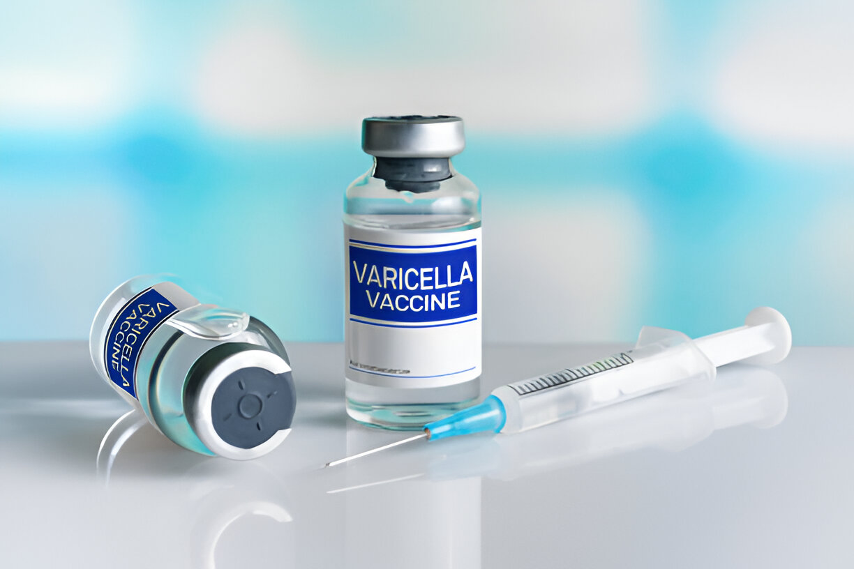 Chickenpox Vaccine